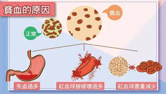 澳门沙金(中国)在线平台关于贫血你了解多少？(图3)